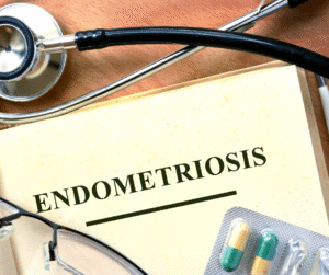 Endometrioza